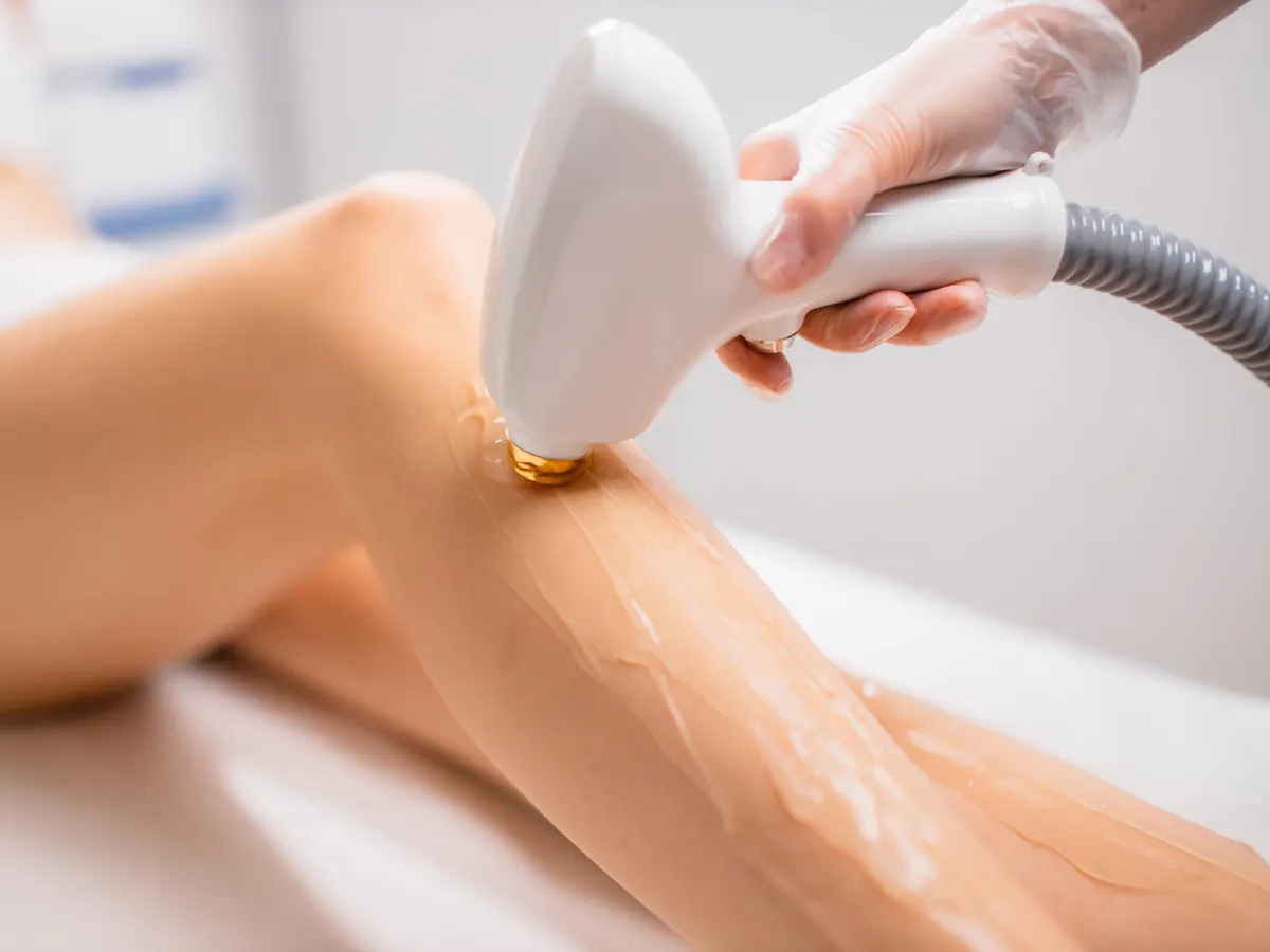 Stock photograph of a model: a laser hair removal handpiece glides along a woman's lower leg