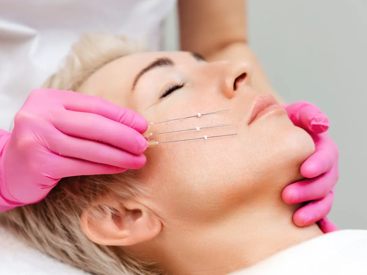 Stock photograph of a model: pink-gloved hands hold fine lifting threads along a blonde woman's cheek and jaw