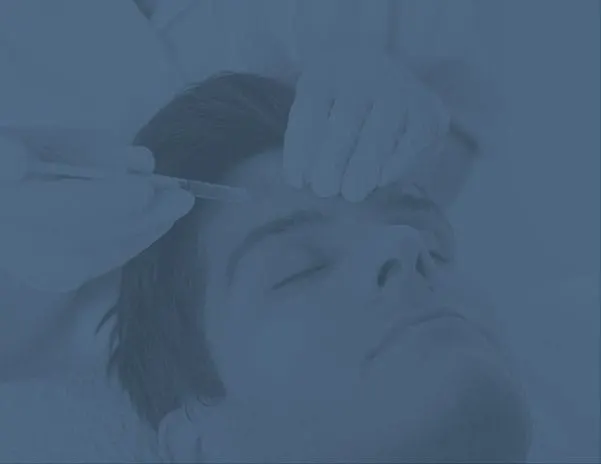 Blue-tinted photo of a person lying back as a gloved hand holds a fine instrument near the forehead