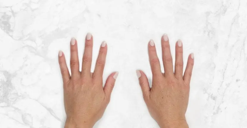 After treatment: both hands, backs up, side by side on white marble