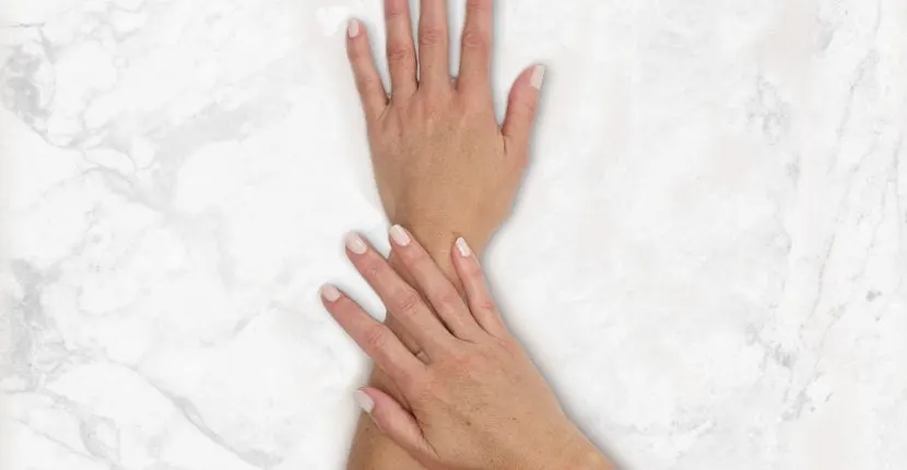 After treatment: the back of one hand with the other hand resting on the wrist, no jewelry, on white marble