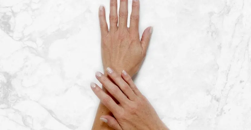 Before treatment: the back of one hand with the other hand resting on the wrist, no jewelry, on white marble