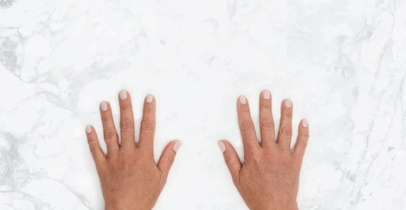 After treatment: both hands, backs up, side by side on white marble