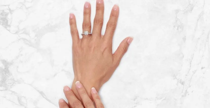 After treatment: the back of one hand wearing a ring, with the other hand resting on the wrist, on white marble
