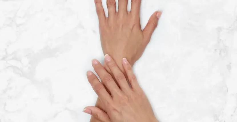 After treatment: the back of one hand with the other hand resting on the wrist, no jewelry, on white marble