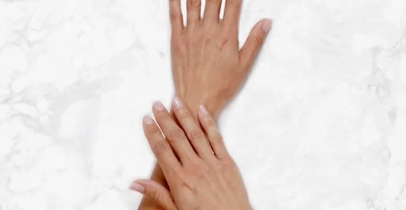 Before treatment: the back of one hand with the other hand resting on the wrist, no jewelry, on white marble