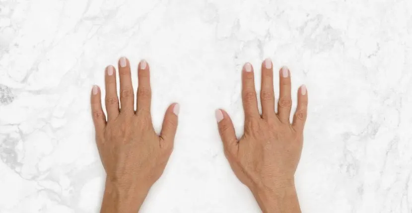 After treatment: both hands, backs up, side by side on white marble