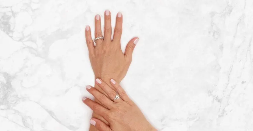 After treatment: the back of one hand wearing a ring, with the other hand resting on the wrist, on white marble