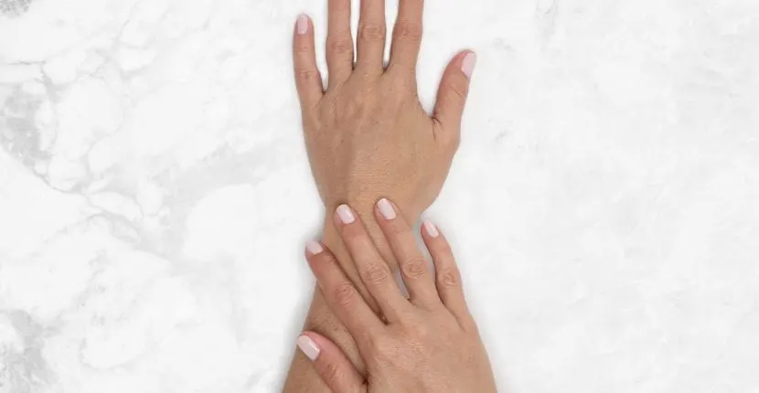 After treatment: the back of one hand with the other hand resting on the wrist, no jewelry, on white marble
