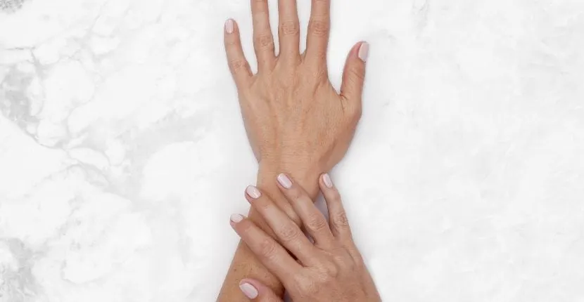 Before treatment: the back of one hand with the other hand resting on the wrist, no jewelry, on white marble