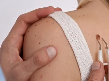 A gloved hand holding a woman's shoulder while a small instrument rests on her skin