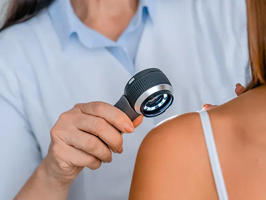 A clinician examining a model's shoulder with a handheld dermatoscope
