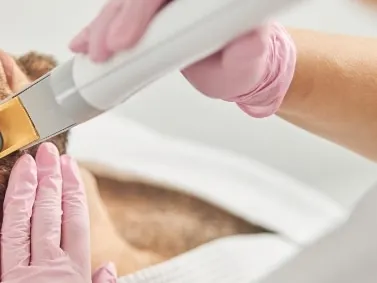 A model lying back receiving a laser treatment on his face from a gloved hand