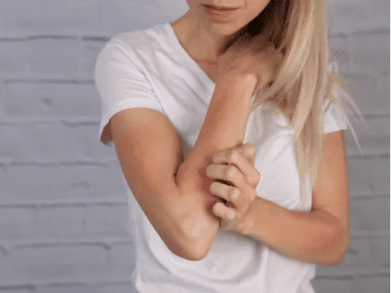 A model in a white t-shirt scratching her forearm