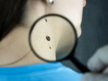 mole