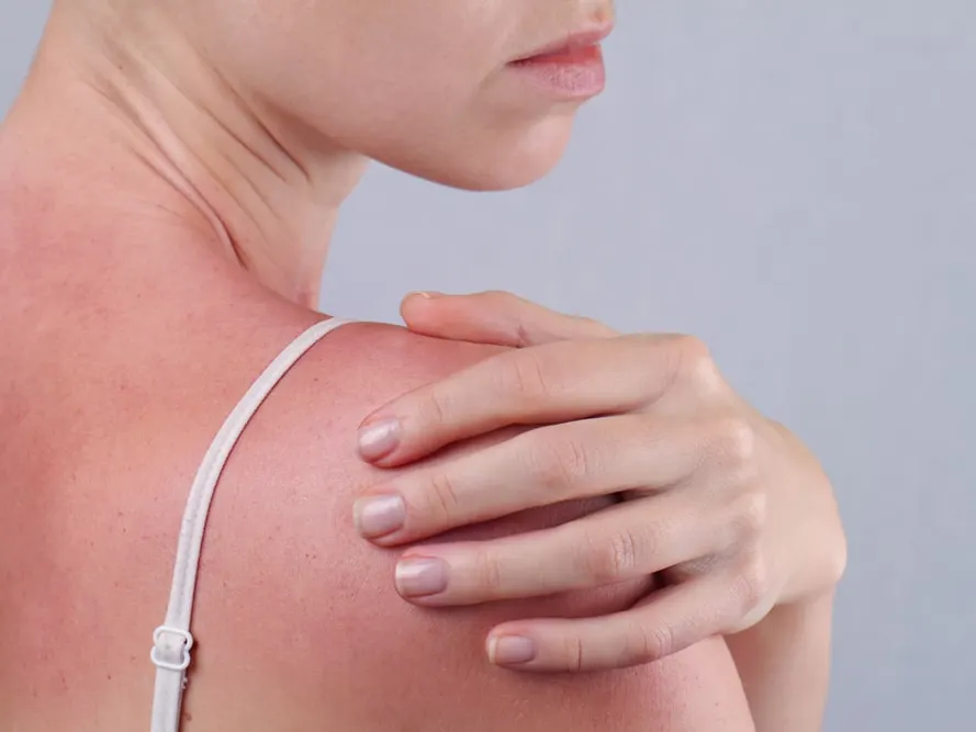 Skin cancer detection in Miami, FL