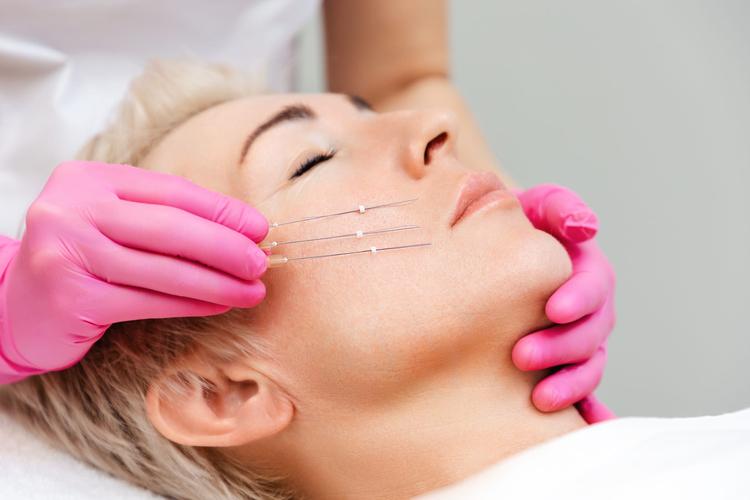 Stock photograph of a model: pink-gloved hands hold fine lifting threads along a blonde woman's cheek and jaw