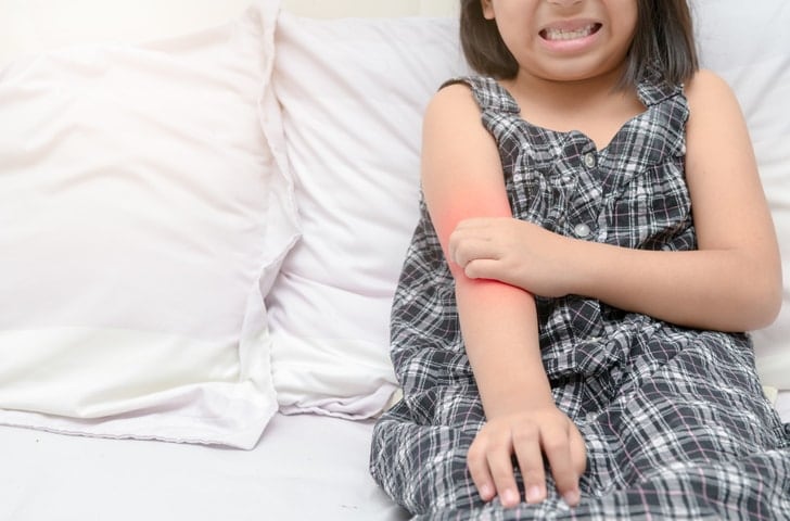 Does my Child have psoriasis
