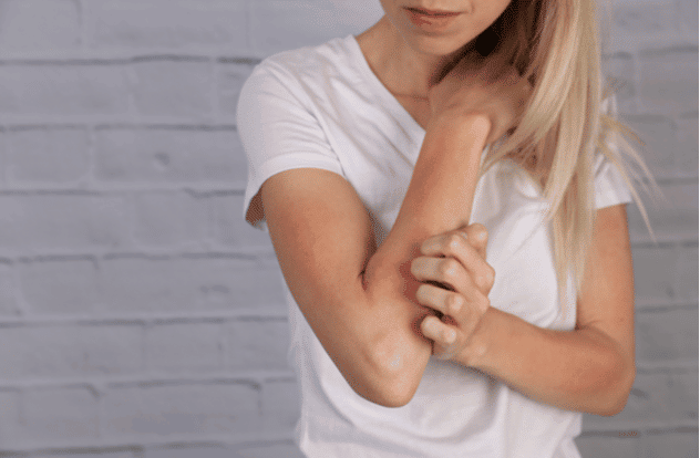 A model in a white t-shirt scratching her forearm