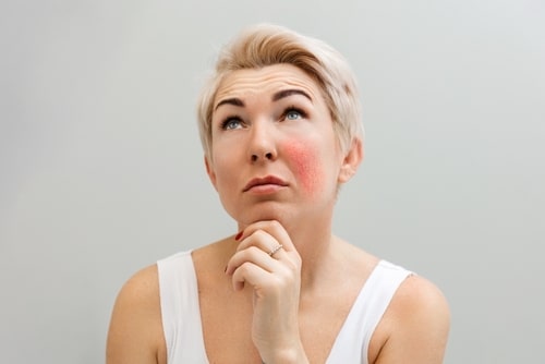 A model with short blonde hair and a red patch on her cheek, looking up thoughtfully