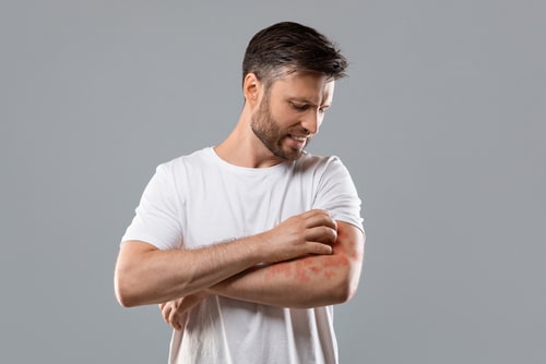 Dermatitis,,Eczema,,Allergy,,Psoriasis,Concept.,Annoyed,Middle aged,Man,In,White