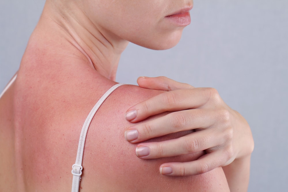 Skin cancer detection in Miami, FL