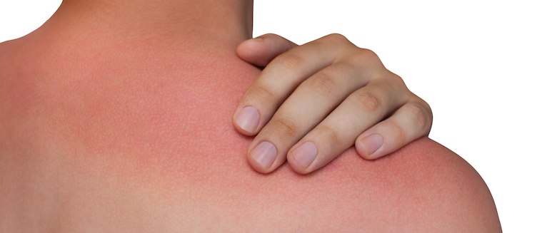 skin damage treatment