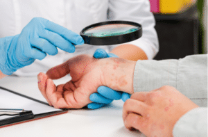 Examination and diagnosis of skin diseases-allergies, psoriasis, eczema, dermatitis.
