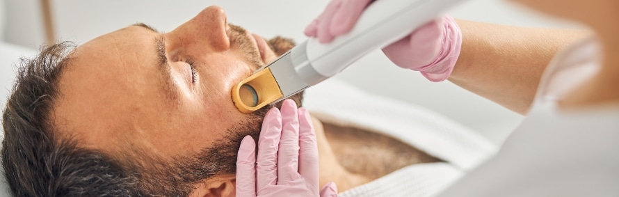 man getting sciton laser treatments on his face